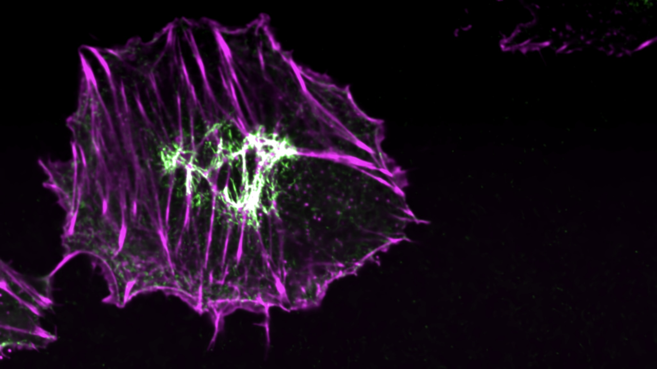 "Image of a cell stain with fluorescent markers of its cytoskeleton"