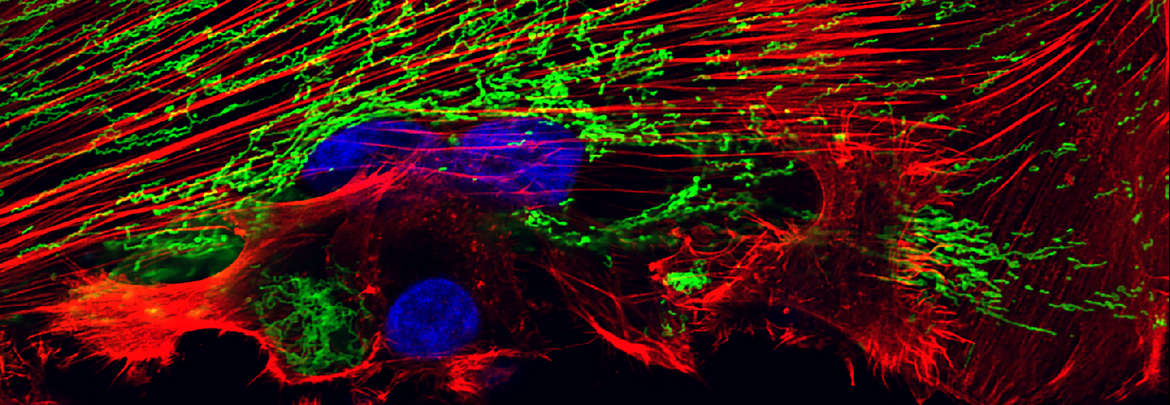 Cell Biology - CBI images cancer cells