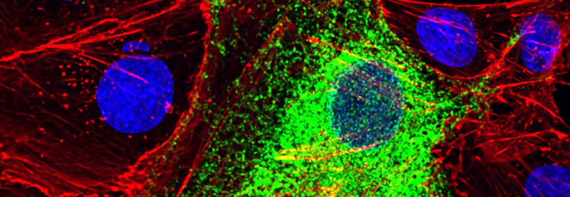 Cell Biology - CBI image Duprex coronavirus