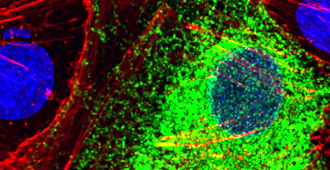 Cell Biology Research - corona duplex