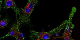 Cardiomyocites image